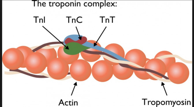 the-elevated-troponin-what-else-besides-acs-could-cause-troponin