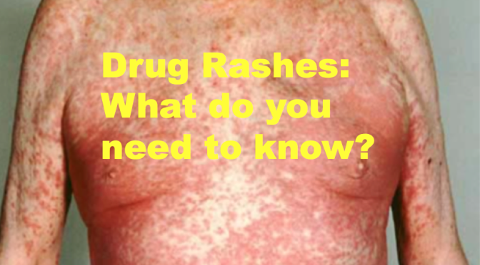 EmDOCs Emergency Medicine EducationDrug Rashes Not Always So 