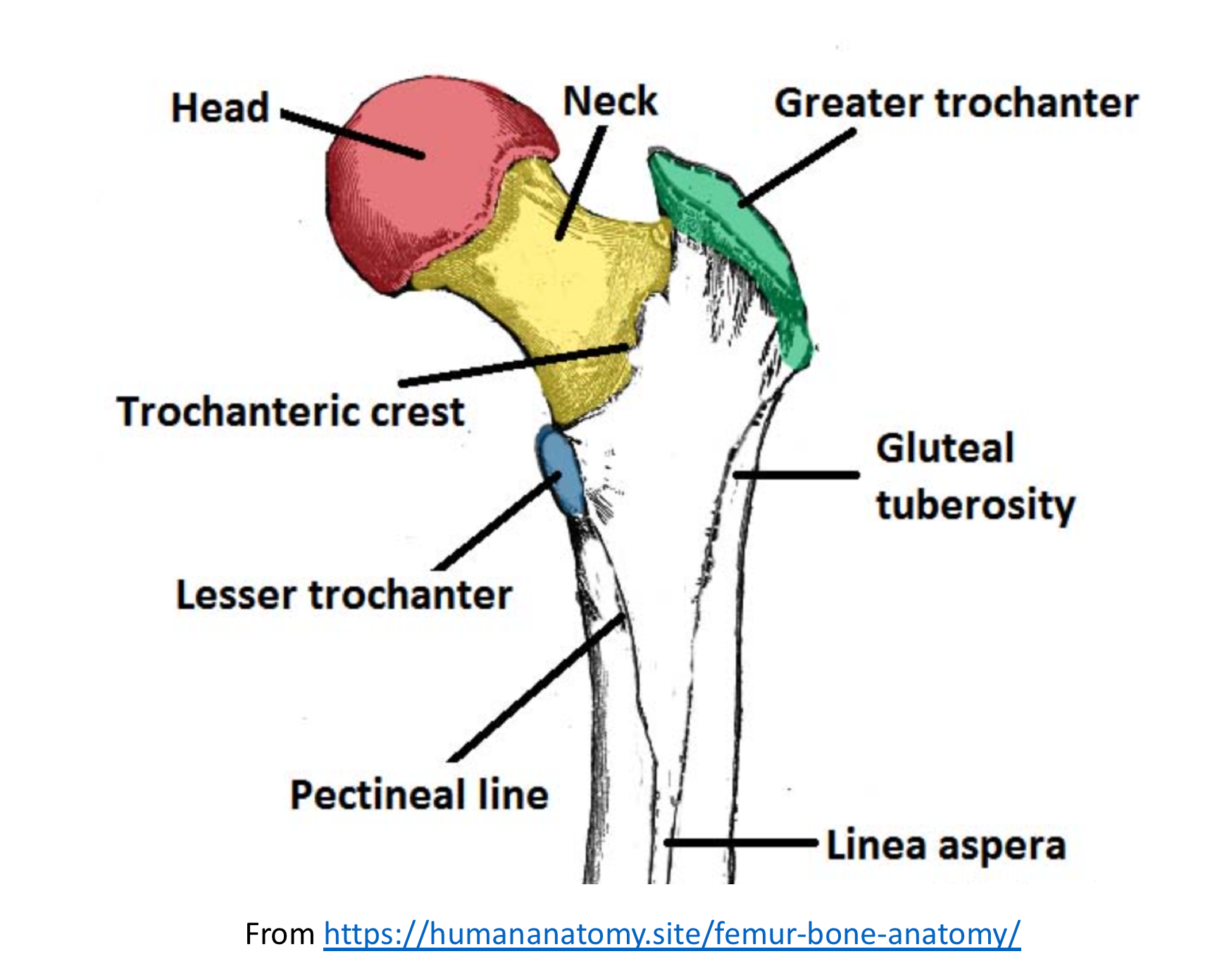 left femoral neck fracture
