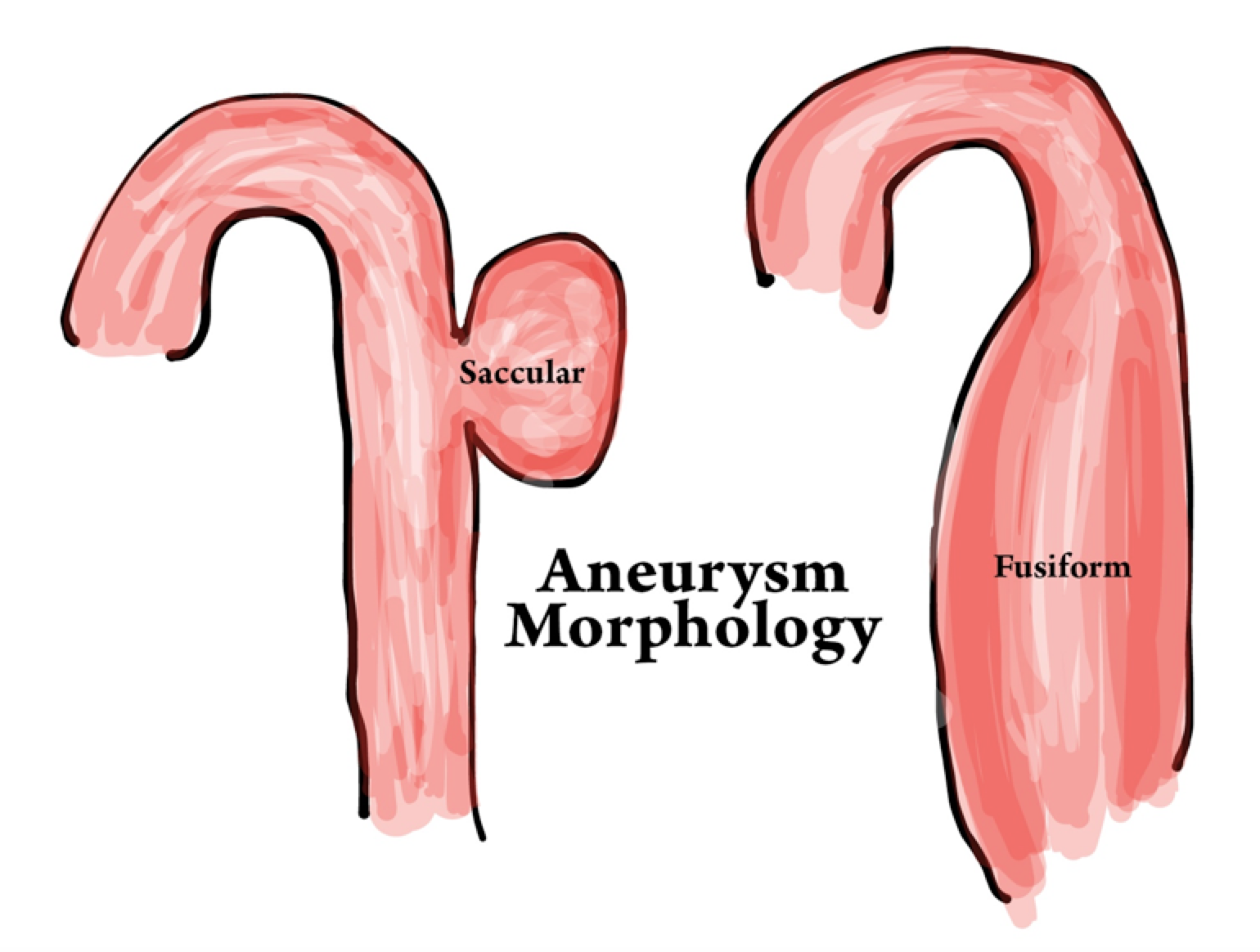 Thoracic Aortic Aneurysm Classification