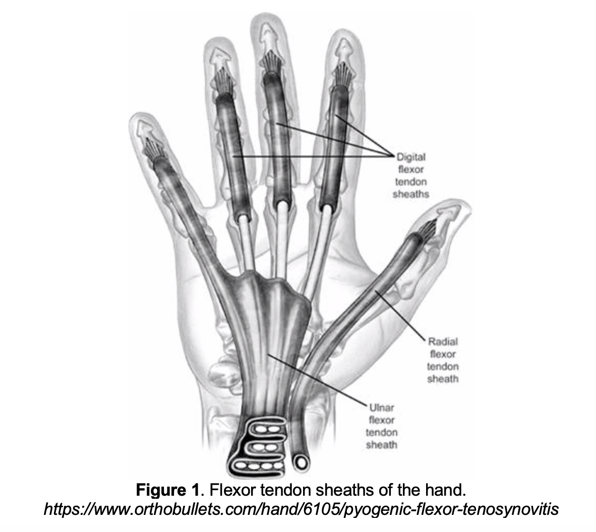 – Emergency Medicine Educationem 3am Pyogenic Flexor