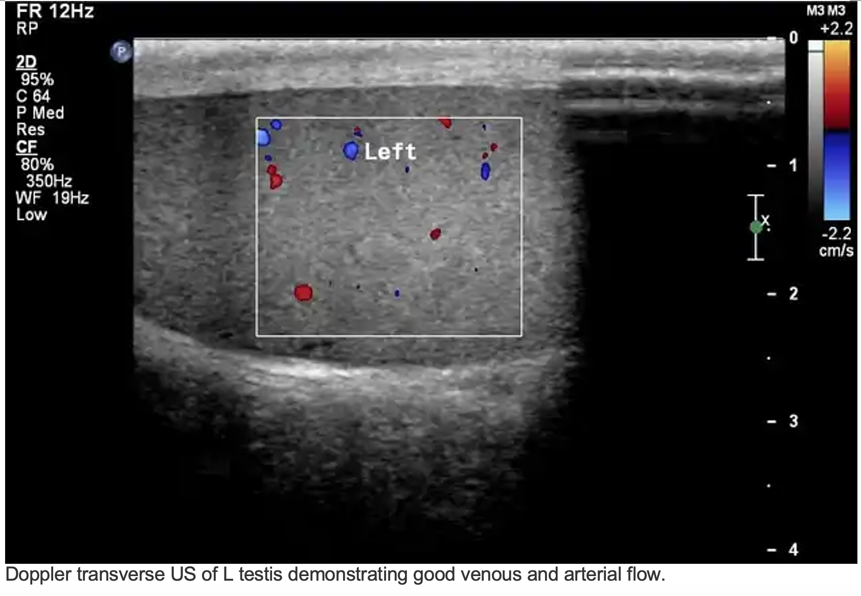 em-3am-testicular-torsion-laptrinhx-news