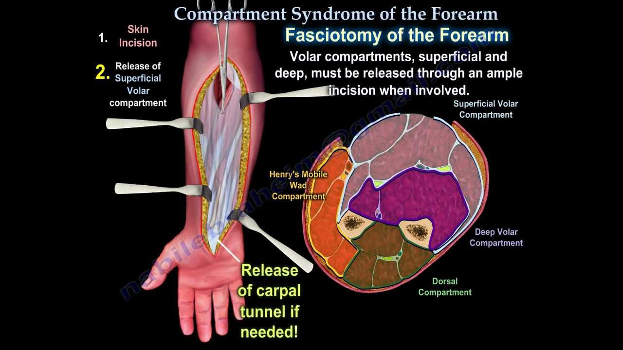 arm compartments