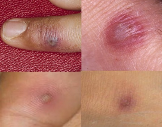 dissem gc findings