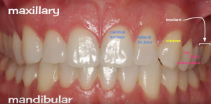 emDOCs.net – Emergency Medicine EducationEM in 5: Dental Fractures ...