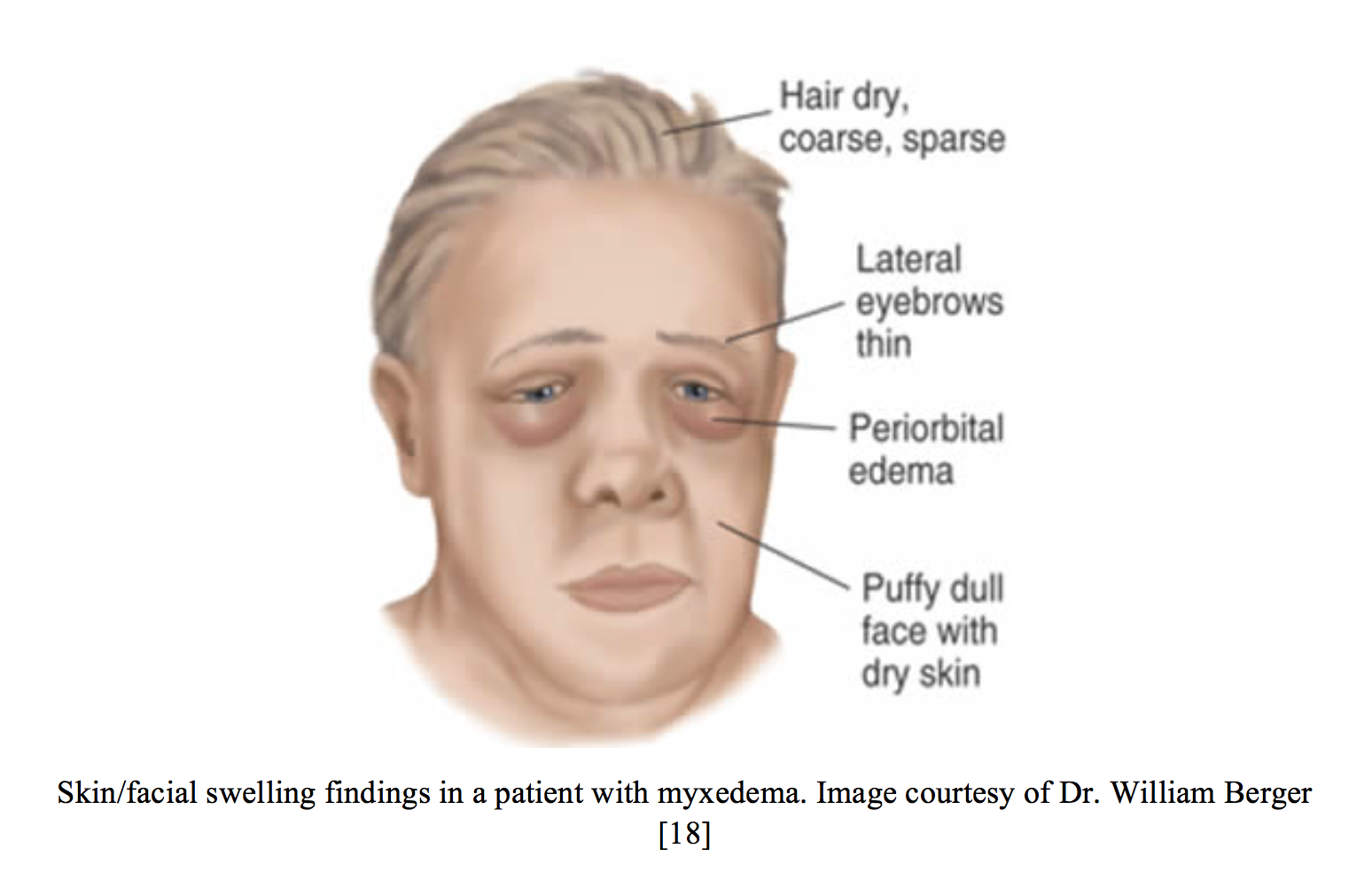 emDOCs.net – Emergency Medicine EducationFacial swelling: Etiologies ...