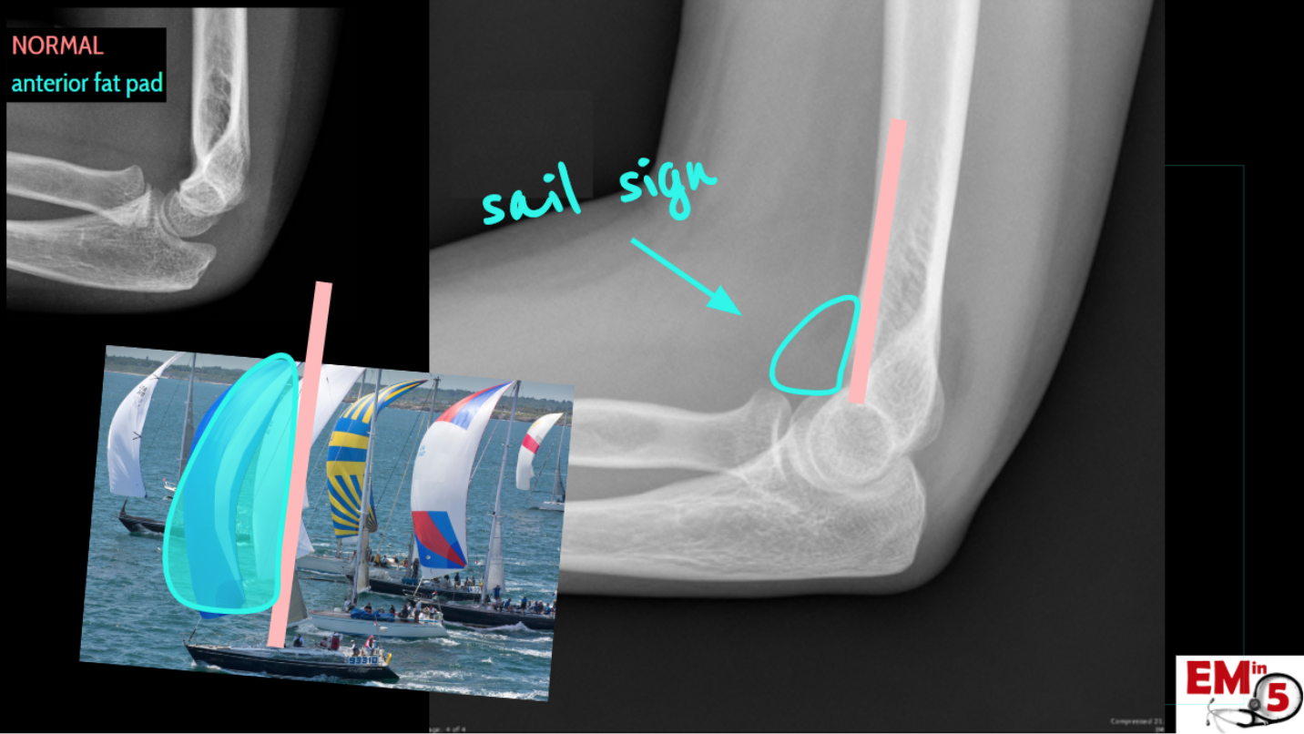 Анатомия XRAY.