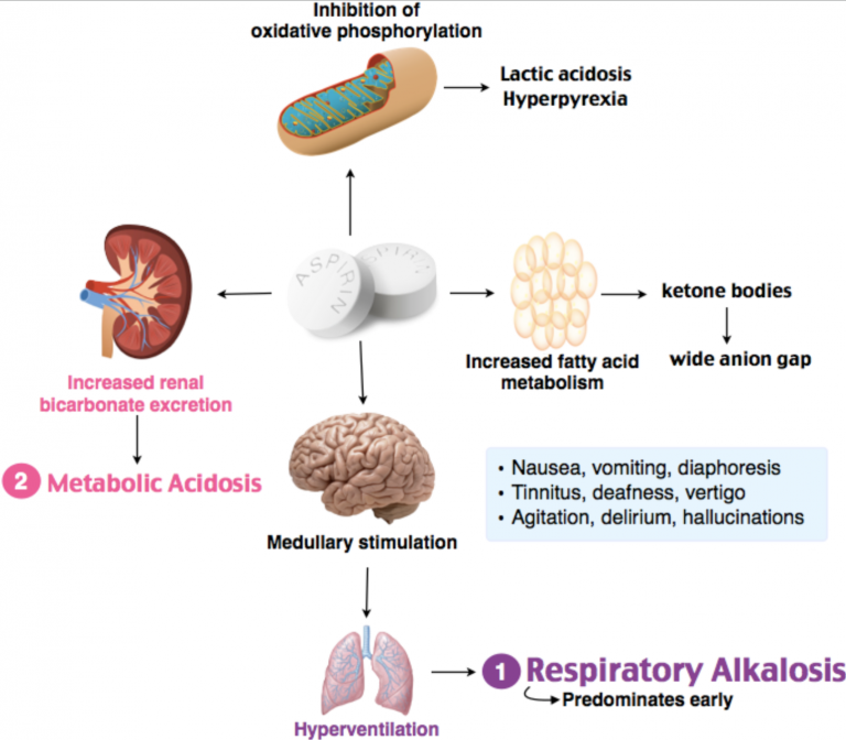 emDOCs.net – Emergency Medicine EducationEM@3AM: Salicylate Overdose ...