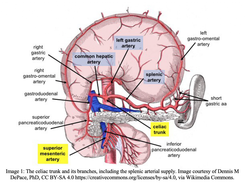 emDOCs.net – Emergency Medicine EducationSplenic Infarction: ED ...