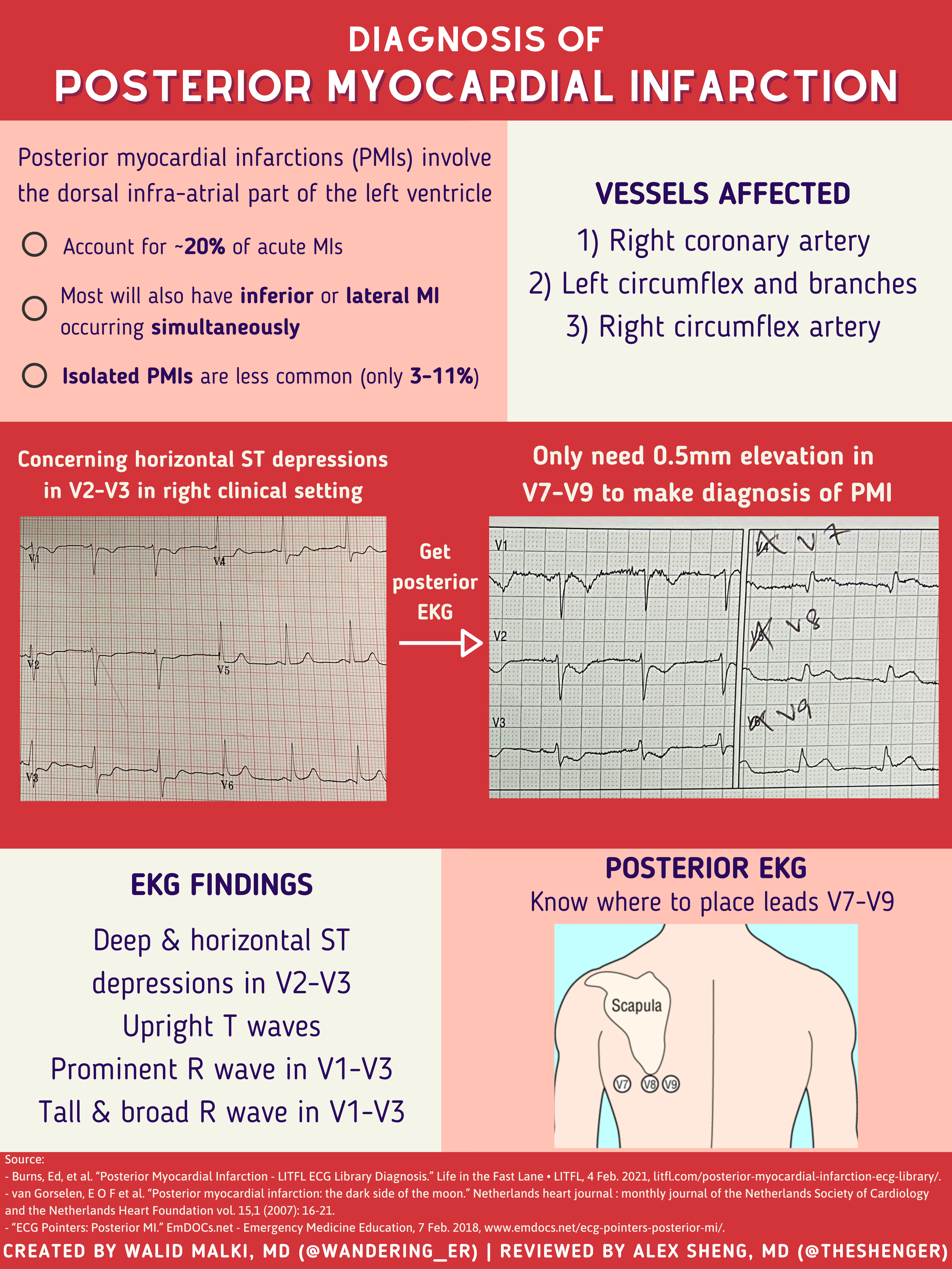 EmDOCs.net – Emergency Medicine EducationVisual Wednesdays: Posterior ...