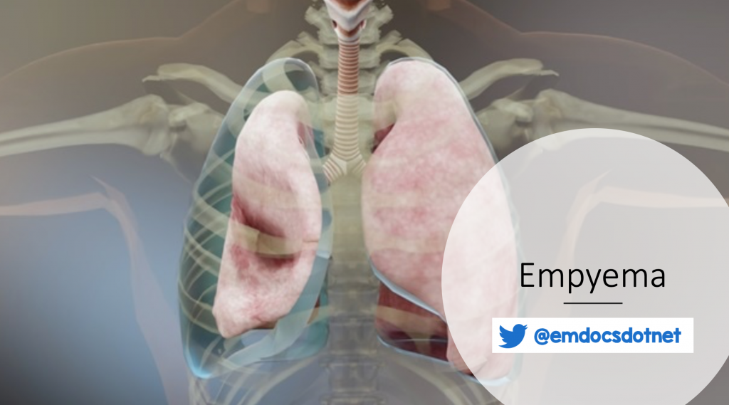 Emdocs Net Emergency Medicine Educationempyema Ed Presentation Evaluation And Management