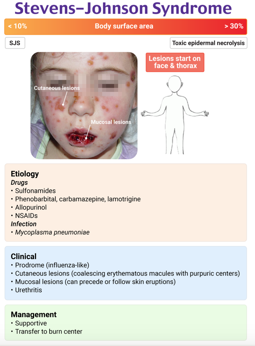 EmDOCs.net – Emergency Medicine EducationEM@3AM: Stevens-Johnson ...