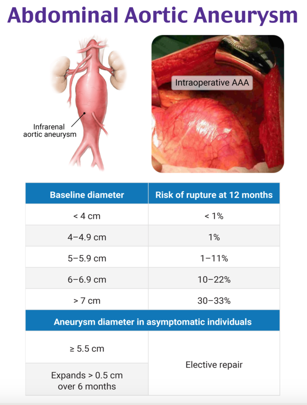 EmDOCs.net – Emergency Medicine EducationEM@3AM: Abdominal Aortic ...