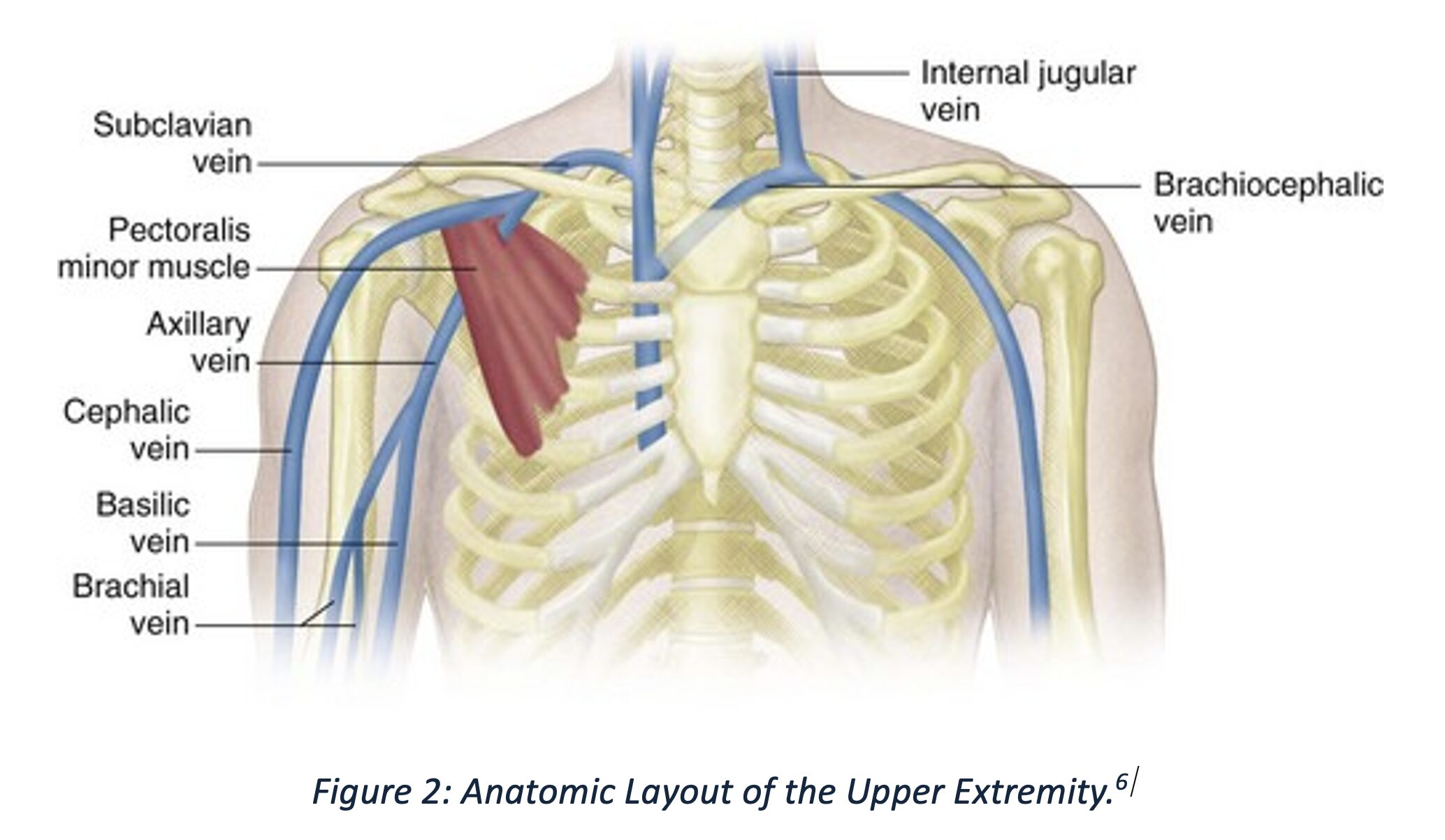 Fig 2 UE DVT