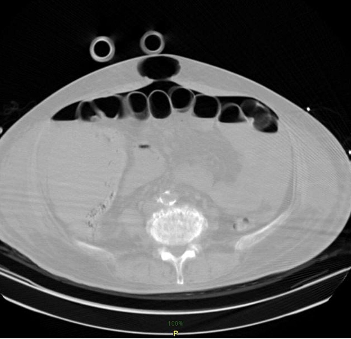figure 6 perforation