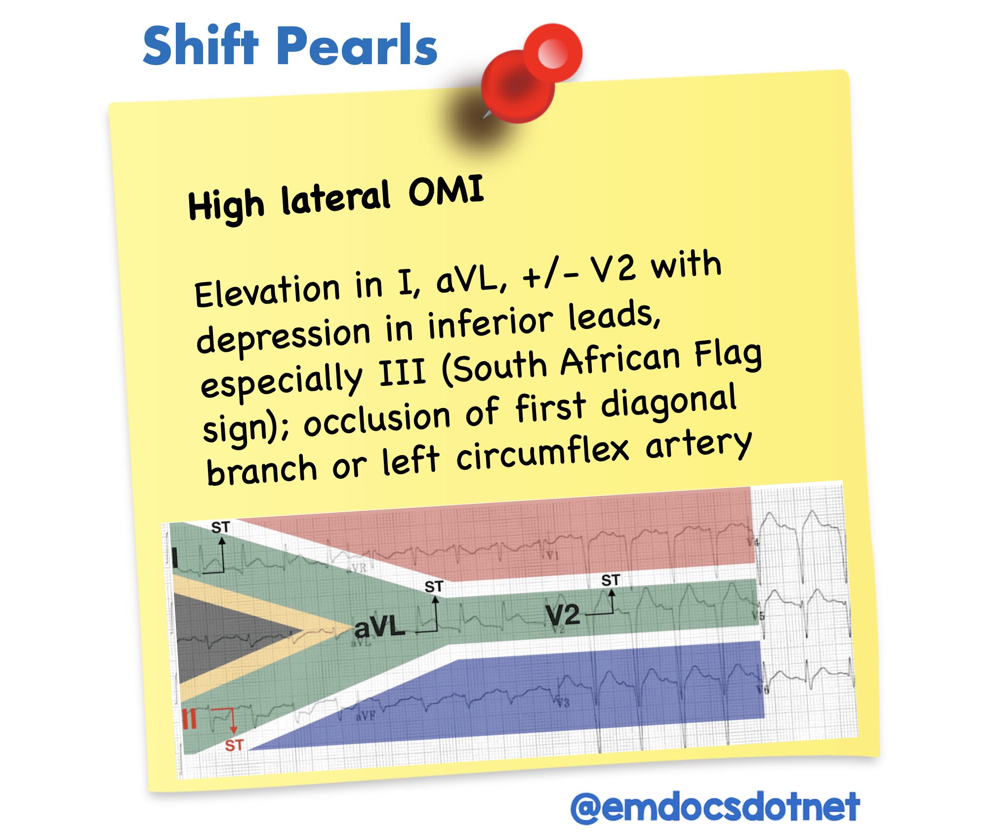 shift lateral omi