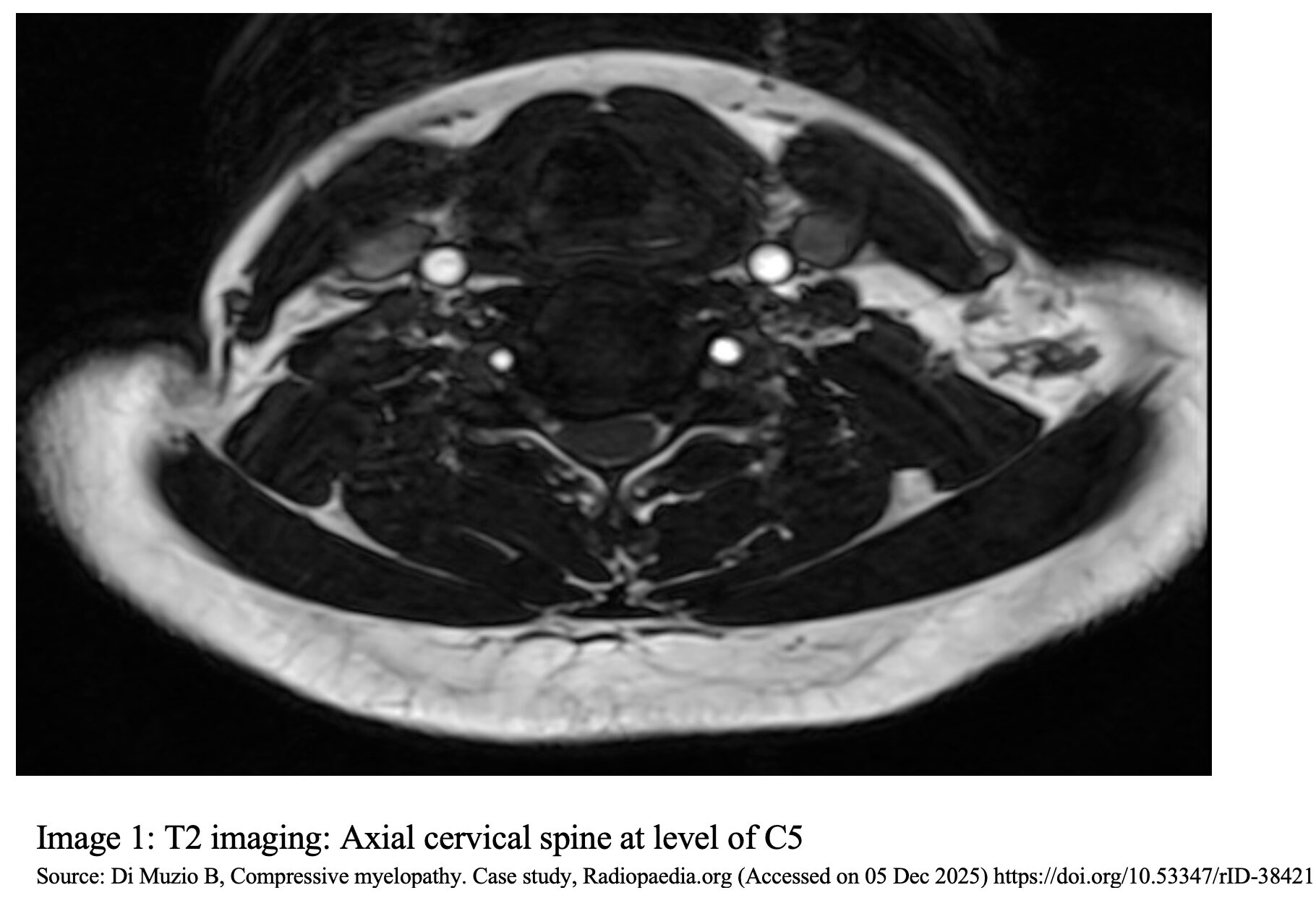 cervical fig 1