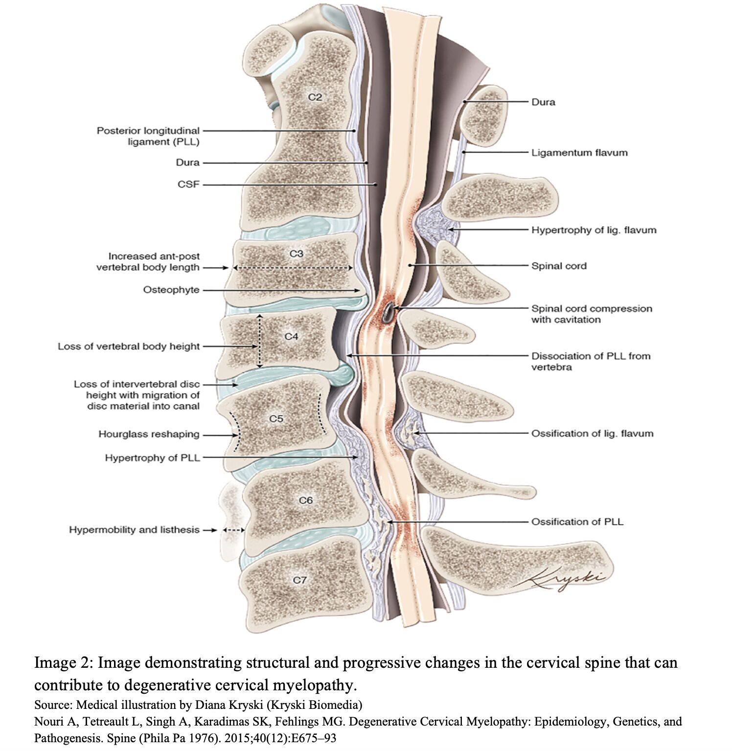 cervical fig 2