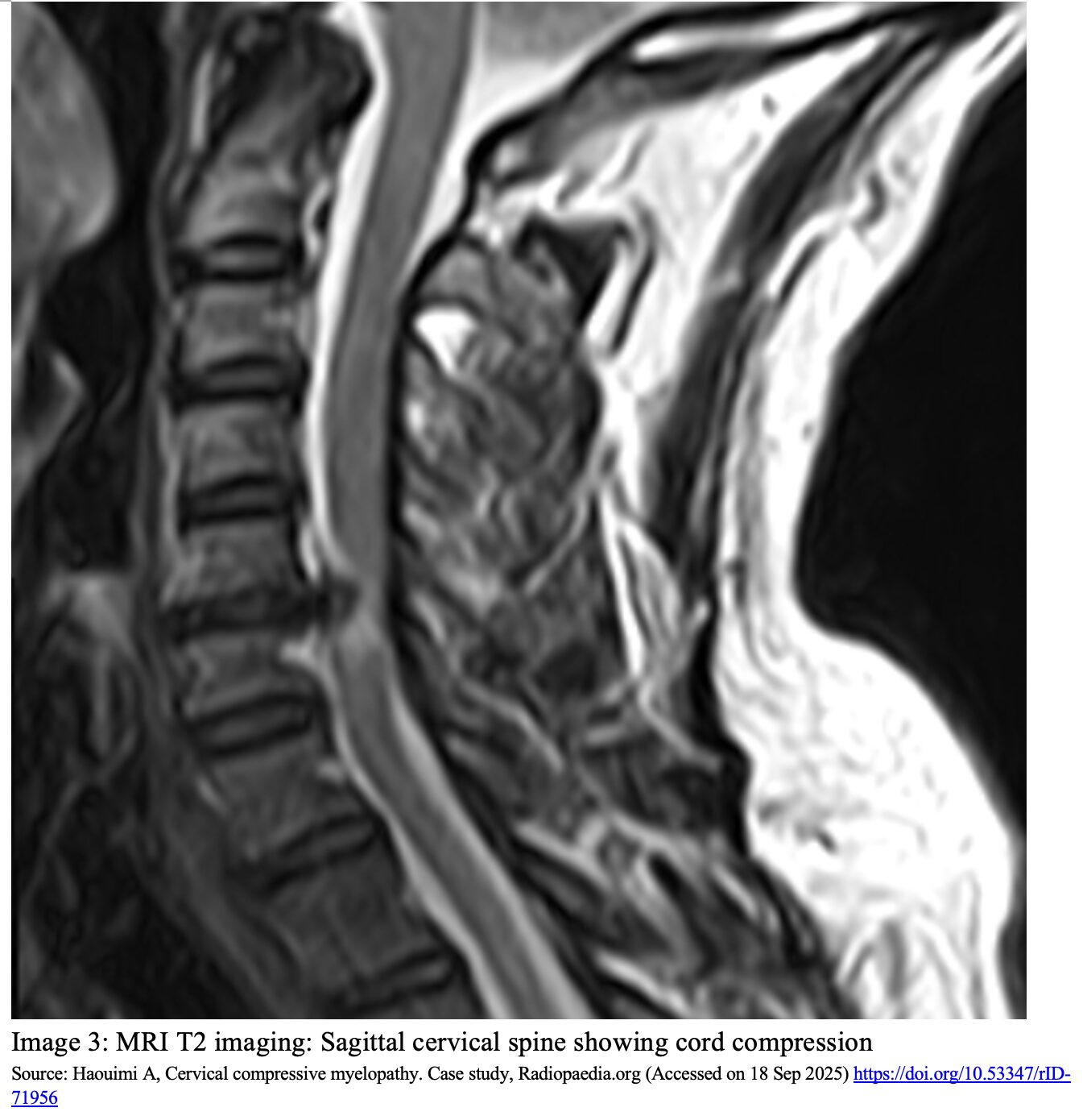 cervical fig 3