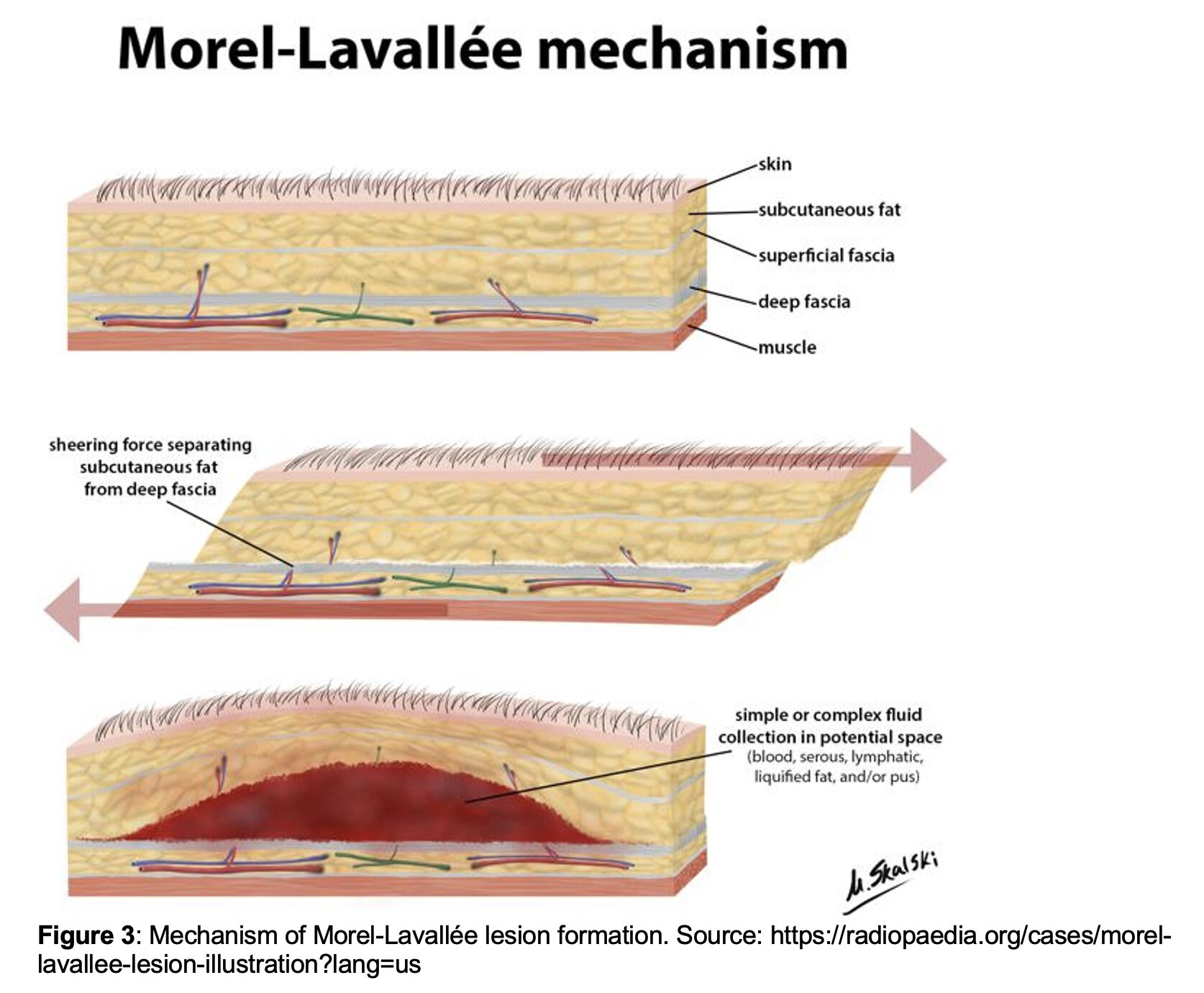 ML Fig 3