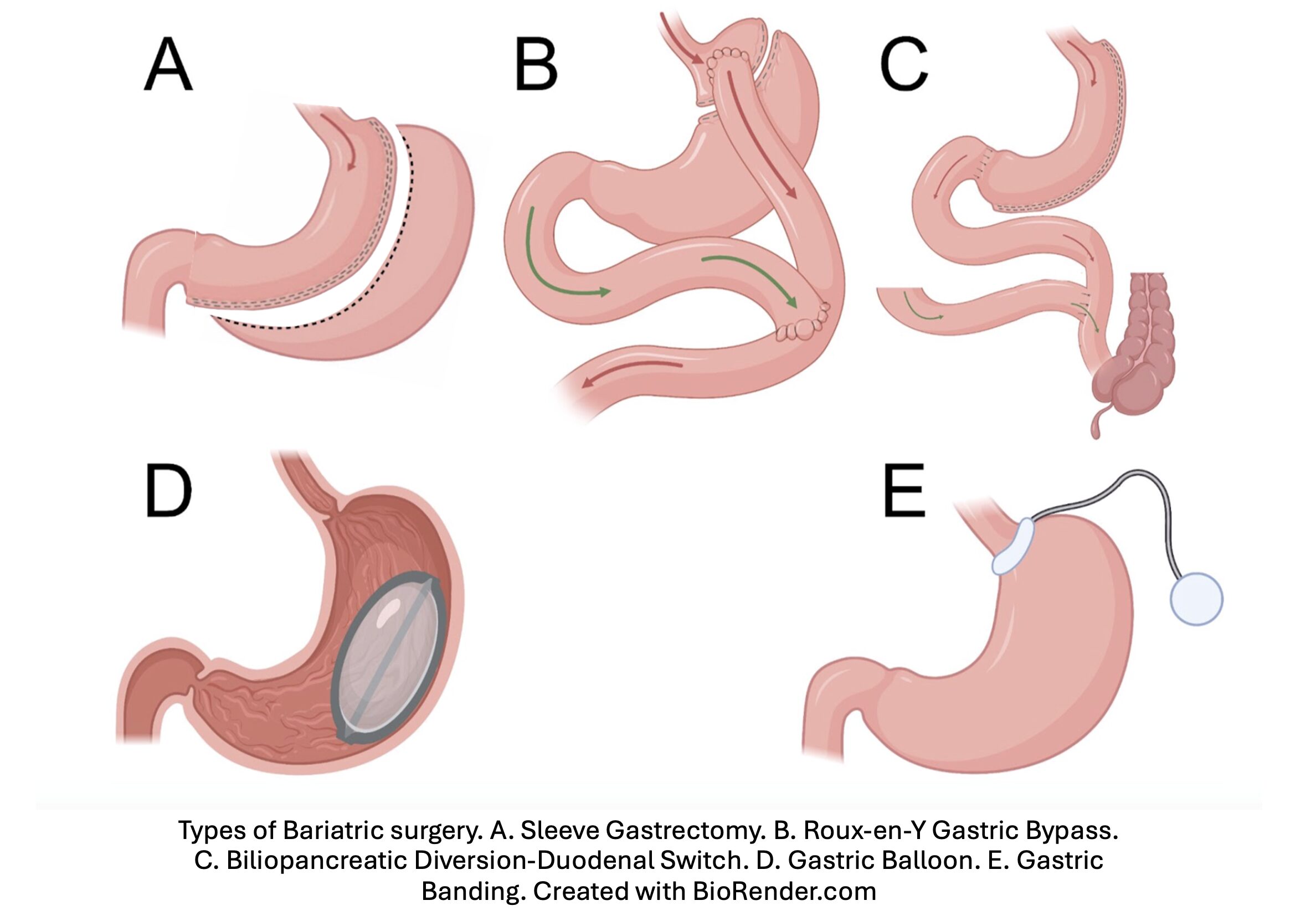 surgery types