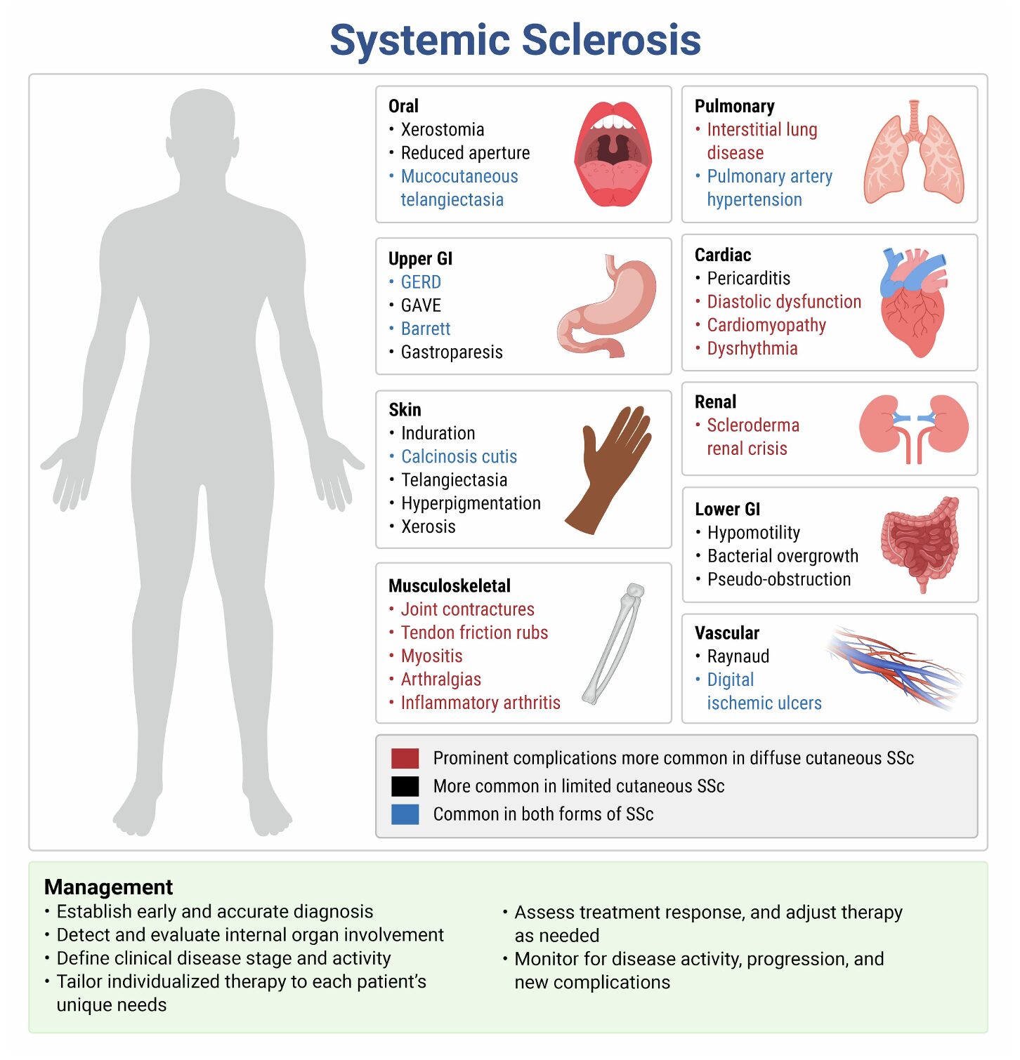 Rosh scleroderma