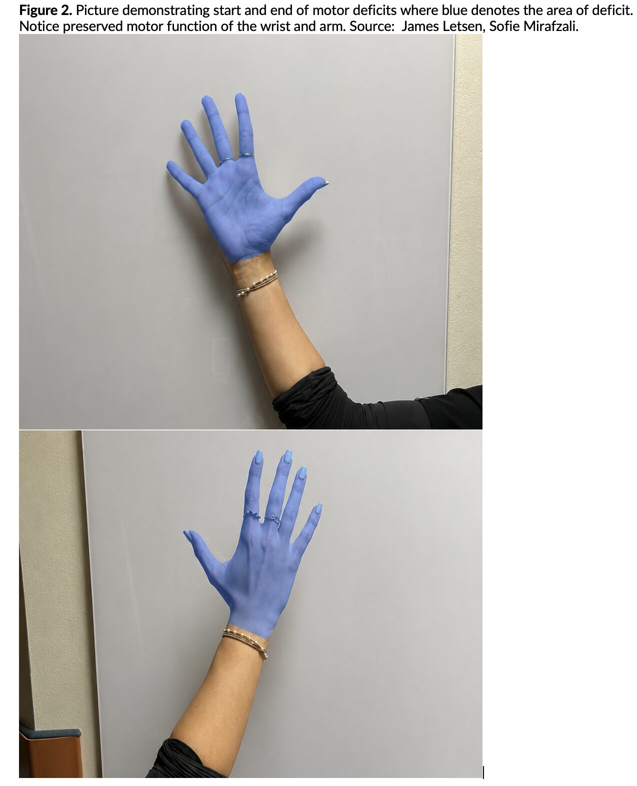 hand stroke